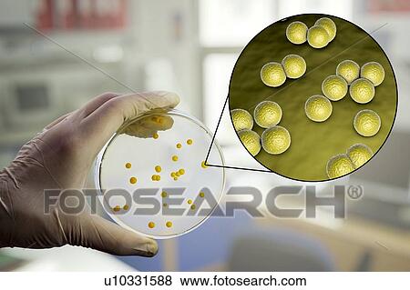 Micrococcus luteus bacteria, composite image View Large Photo Image Stock Photo - Micrococcus luteus bacteria, composite image. Fotosearch