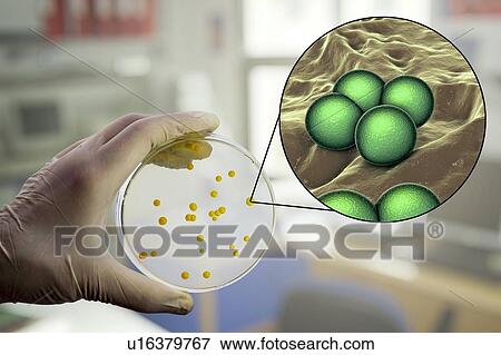Micrococcus luteus bacteria, composite image View Large Photo Image Stock Photo - Micrococcus luteus bacteria, composite image. Fotosearch
