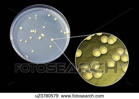 Stock Photo - Micrococcus luteus bacteria, composite image. Fotosearch