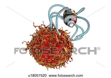 Stock Image - Nanorobots attacking cancer, illustration. Fotosearch