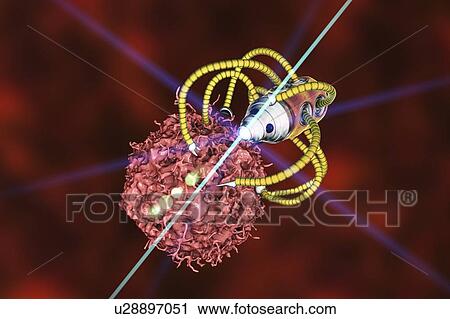 Nanorobots attacking cancer, illustration View Large Photo Image Stock Image - Nanorobots attacking cancer, illustration. Fotosearch