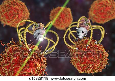 Stock Photo - Nanorobots attacking cancer, illustration. Fotosearch