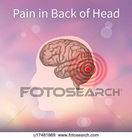 Stock Photo - Pain in back of the head, illustration. Fotosearch