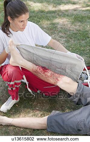 Paramedic placing bandage on leg with third degree burns View Large Photo Image Stock Image - Paramedic placing bandage on leg with third degree burns. Fotosearch