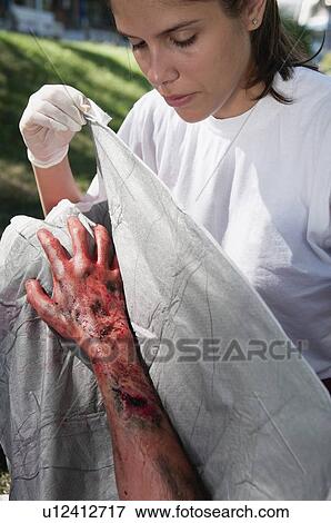 Stock Photo - Paramedic treating a victim with third degree burns. Fotosearch