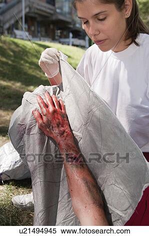 Paramedic treating a victim with third degree burns View Large Photo Image Stock Photography - Paramedic treating a victim with third degree burns. Fotosearch