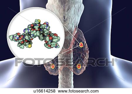 Stock Photo - Parathyroid glands and parathyroid hormone, illustration. Fotosearch