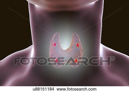 Parathyroid glands, illustration View Large Photo Image Picture - Parathyroid glands, illustration. Fotosearch