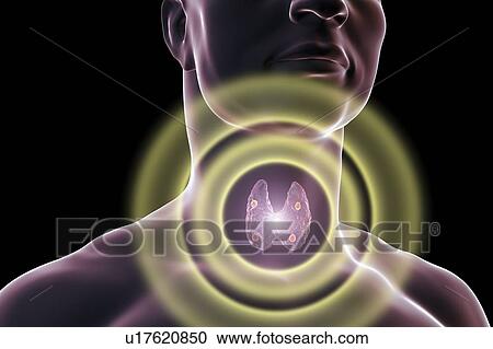 Parathyroid glands, illustration View Large Photo Image Stock Image - Parathyroid glands, illustration. Fotosearch