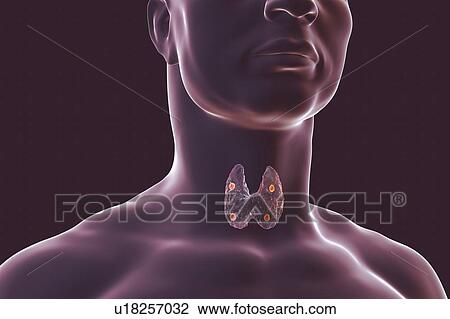 Stock Image - Parathyroid glands, illustration. Fotosearch
