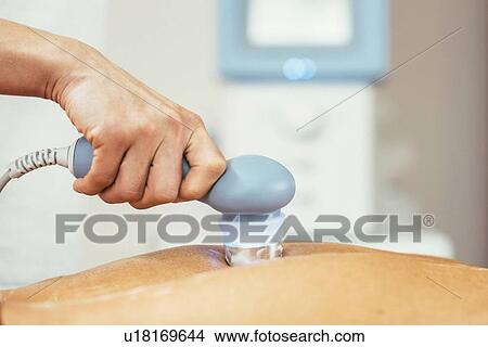 Picture - Physiotherapist using ultrasound. Fotosearch