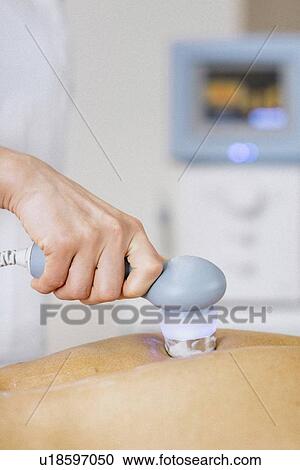 Stock Image - Physiotherapist using ultrasound. Fotosearch