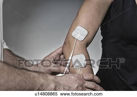 Stock Photography - Placing TENS electrodes on arm. Fotosearch