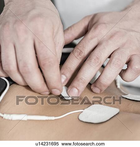 Stock Photography - Placing TENS electrodes on back. Fotosearch