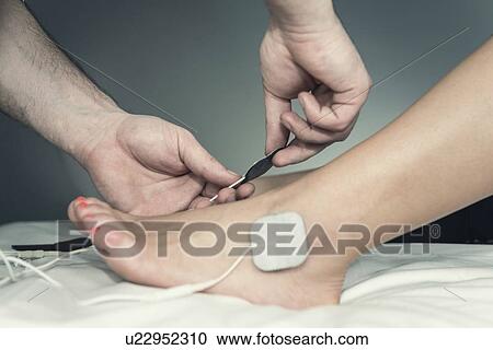 Placing TENS electrodes on foot View Large Photo Image Stock Image - Placing TENS electrodes on foot. Fotosearch
