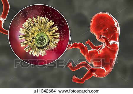 Picture - Prevention of transplacental HIV transmission, illustration. Fotosearch