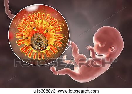 Prevention of transplacental HIV transmission, illustration View Large Photo Image Stock Image - Prevention of transplacental HIV transmission, illustration. Fotosearch