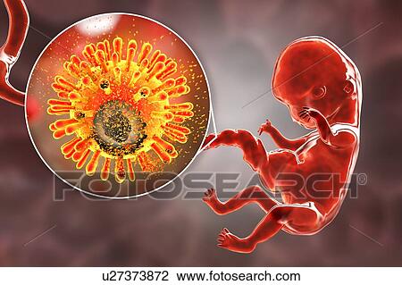 Stock Image - Prevention of transplacental HIV transmission, illustration. Fotosearch