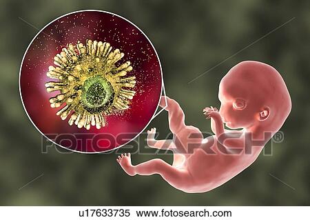 Prevention of transplacental HIV transmission, illustration View Large Photo Image Stock Photography - Prevention of transplacental HIV transmission, illustration. Fotosearch