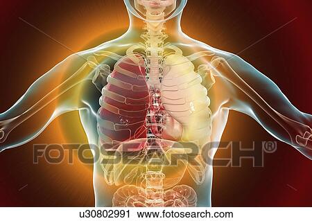 Stock Image - Red hepatisation of lobar pneumonia, conceptual illustration. Fotosearch
