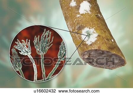 Stock Image - Smoked sausage with mould, composite image. Fotosearch