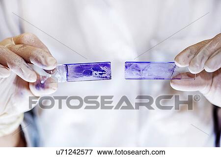 Stained microscope slides View Large Photo Image Stock Photo - Stained microscope slides. Fotosearch