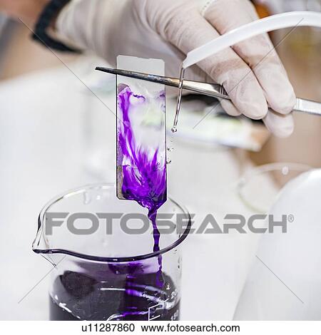 Stock Image - Staining microscope slide. Fotosearch