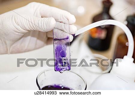 Staining microscope slide View Large Photo Image Stock Image - Staining microscope slide. Fotosearch