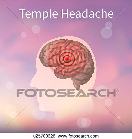 Stock Photograph - Temple headache, illustration. Fotosearch