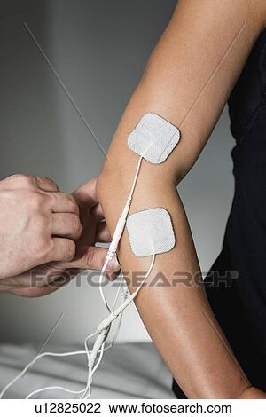 Stock Image - TENS therapy. Fotosearch