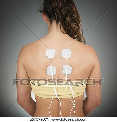 Stock Image - TENS therapy. Fotosearch