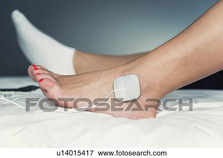 Stock Photo - TENS therapy. Fotosearch