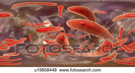 Stock Photo - Tuberculosis bacteria, illustration. Fotosearch