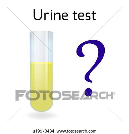 Urinary sample, illustration View Large Photo Image Picture - Urinary sample, illustration. Fotosearch