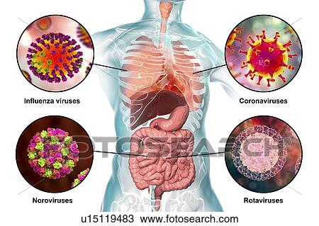 Stock Image - Viral respiratory and enteric infections, illustration. Fotosearch
