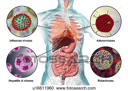 Stock Image - Viral respiratory and enteric infections, illustration. Fotosearch