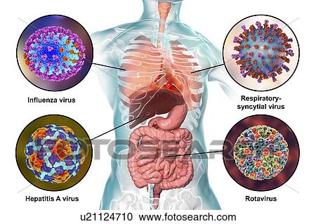 Stock Image - Viral respiratory and enteric infections, illustration. Fotosearch