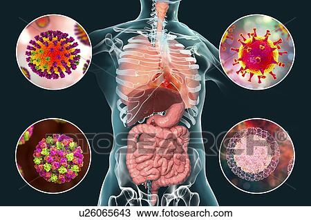 Viral respiratory and enteric infections, illustration View Large Photo Image Stock Image - Viral respiratory and enteric infections, illustration. Fotosearch