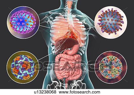 Stock Photo - Viral respiratory and enteric infections, illustration. Fotosearch
