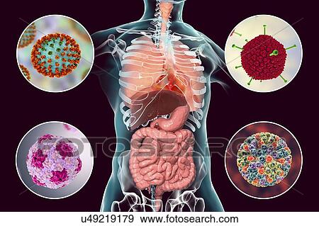 Viral respiratory and enteric infections, illustration View Large Photo Image Stock Photo - Viral respiratory and enteric infections, illustration. Fotosearch