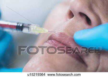 Picture - Woman having hyaluronic acid injections. Fotosearch