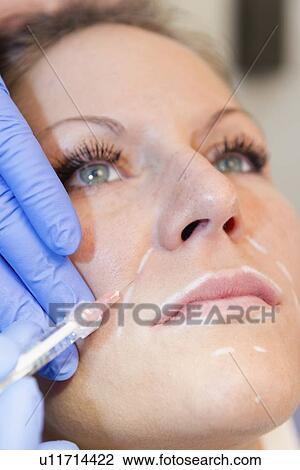 Woman having hyaluronic acid injections View Large Photo Image Stock Image - Woman having hyaluronic acid injections. Fotosearch