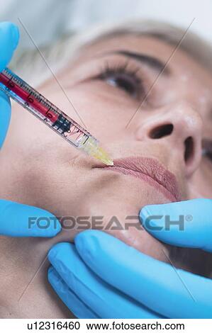 Stock Image - Woman having hyaluronic acid injections. Fotosearch