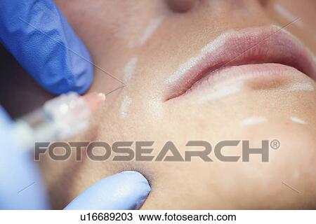 Woman having hyaluronic acid injections View Large Photo Image Stock Image - Woman having hyaluronic acid injections. Fotosearch