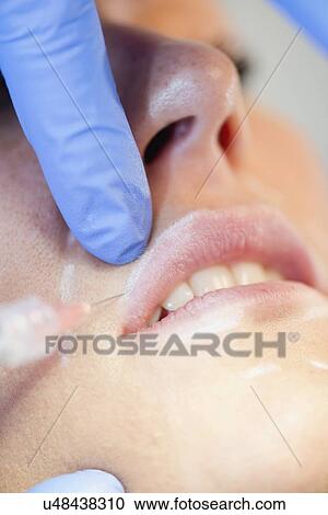 Stock Image - Woman having hyaluronic acid injections. Fotosearch