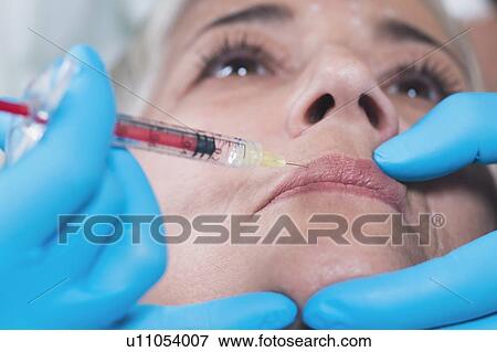 Woman having hyaluronic acid injections View Large Photo Image Stock Photo - Woman having hyaluronic acid injections. Fotosearch