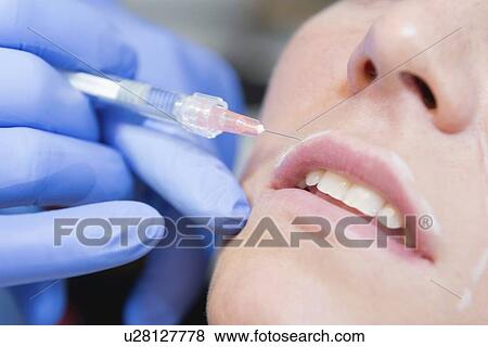 Stock Photo - Woman having hyaluronic acid injections. Fotosearch