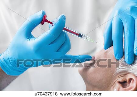 Stock Photo - Woman having hyaluronic acid injections. Fotosearch