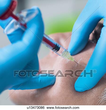 Stock Photograph - Woman having hyaluronic acid injections. Fotosearch