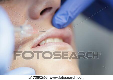 Stock Photograph - Woman having hyaluronic acid injections. Fotosearch